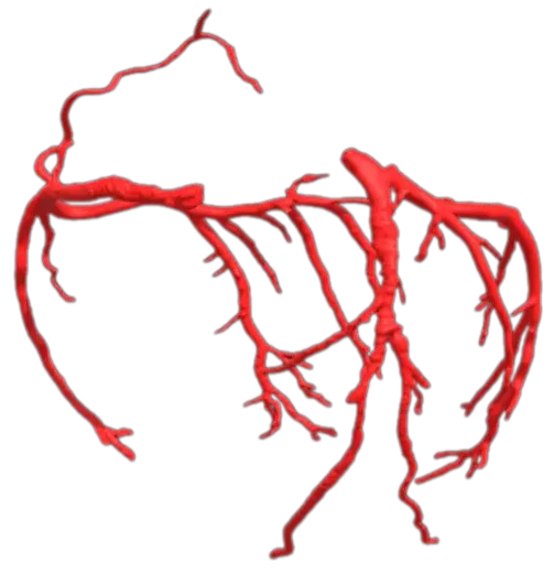 Heart0088 Coronary Arteries