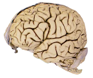 Cortical-Surface-and-Dura